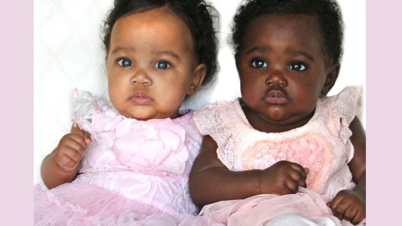 Bliźniaczki o różnych kolorach skóry oczarowały internautów. Zobaczcie, jak wyglądają dziś niezwykłe siostry!