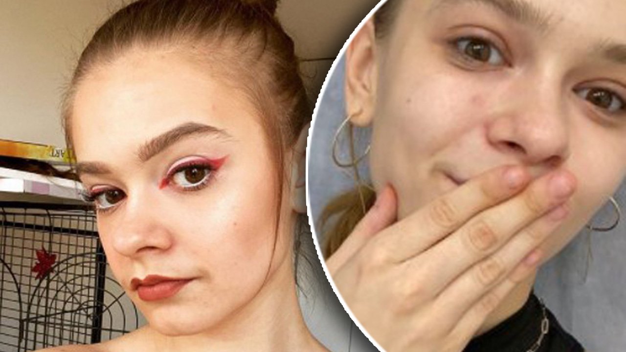 22-letnia Julia Wróblewska powiększyła usta! "Ale opuchłam" - napisała młoda aktorka