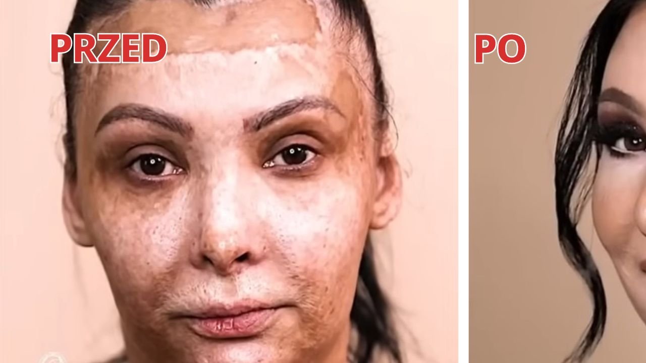 Szokująca metamorfoza 45-latki z bliznami - nie uwierzysz, jak bardzo odmienił ją makijaż!