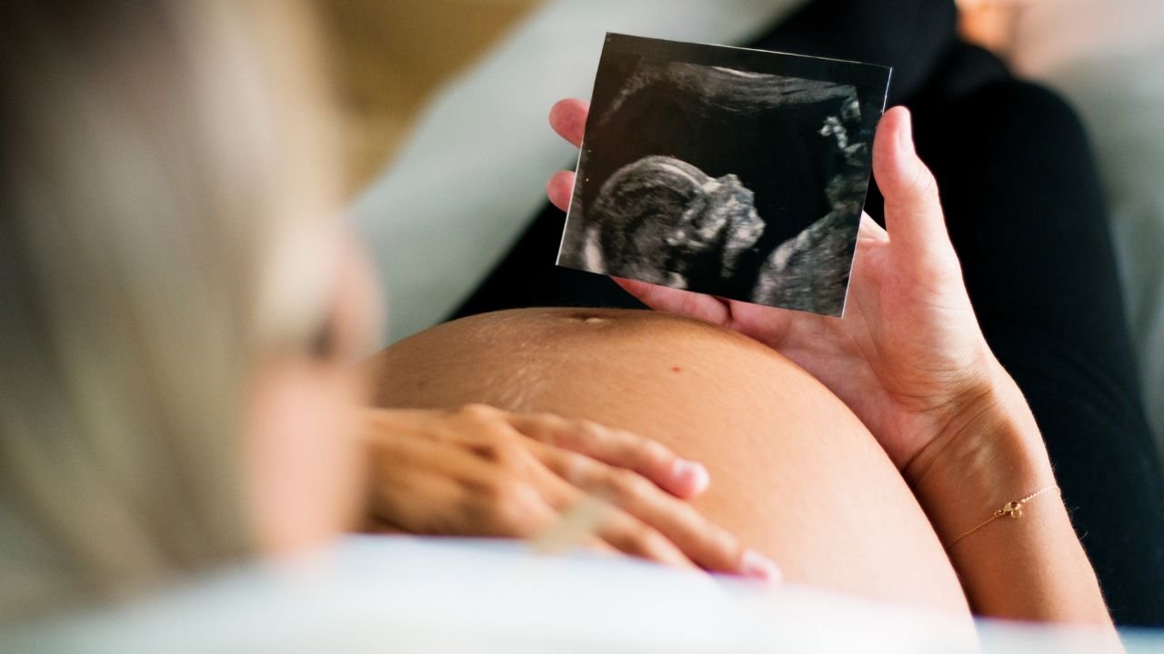 ciężarna kobieta trzyma usg