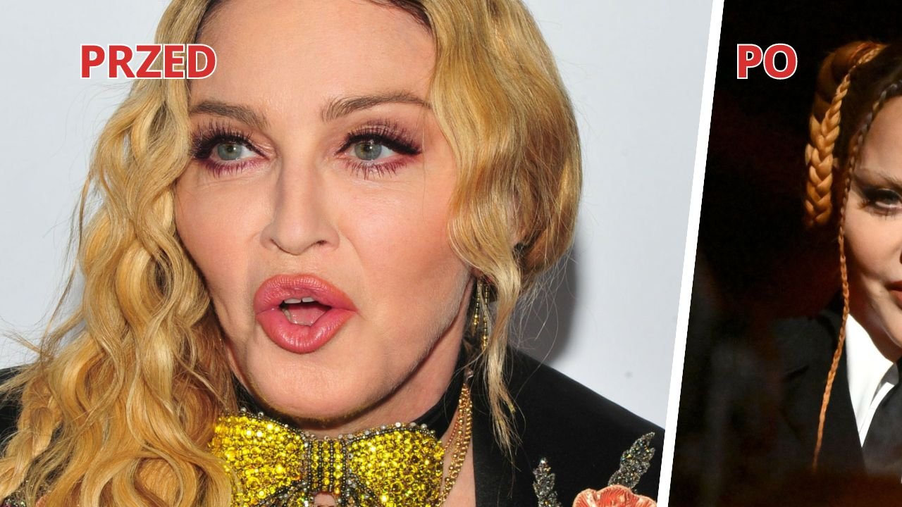 Madonna z "napompowaną" twarzą na Grammy 2023! "Kim jest ta dziewczyna?!" - pytają zaniepokojeni internauci