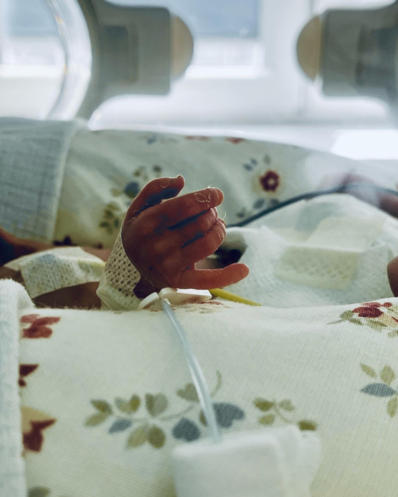 zdjęcie maleńskiej rączki dziecka przebywającego w inkubatorze