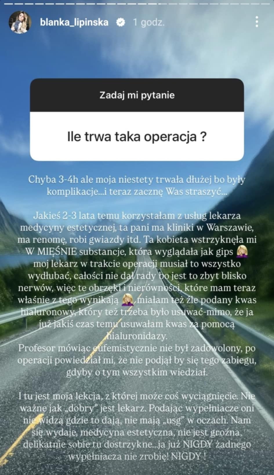 Blanka Lipińska o liftingu twarzy