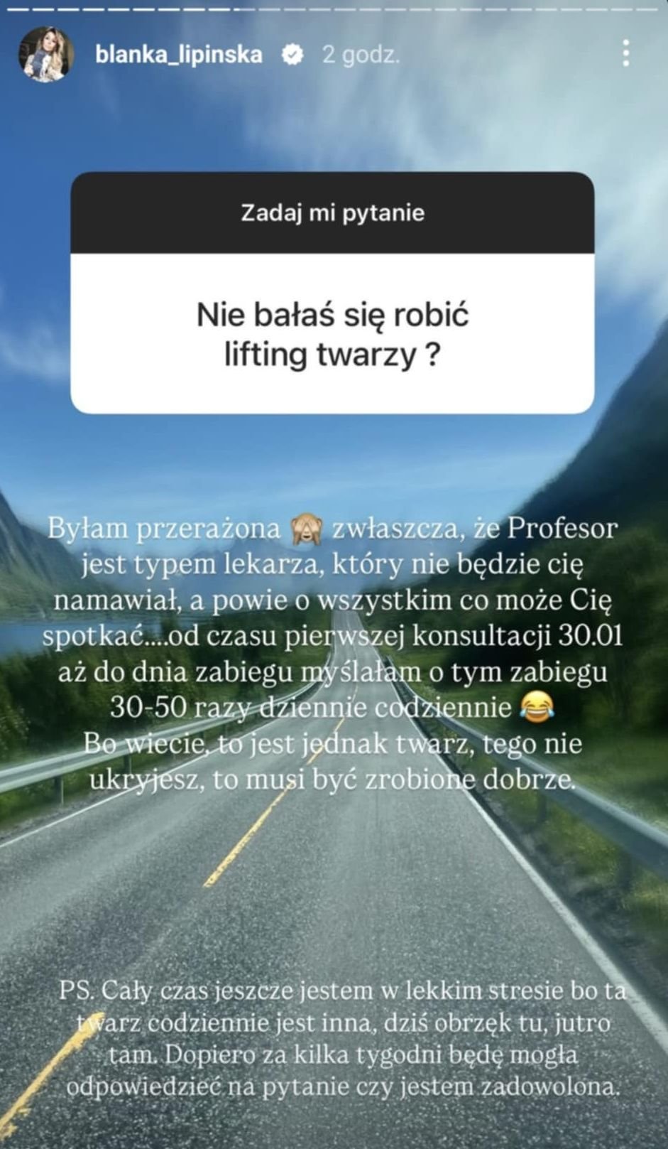 Blanka Lipińska o liftingu twarzy