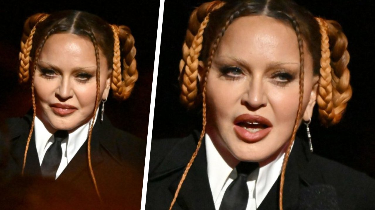 Madonna już tak nie wygląda. Zakonserwowana 66-latka pokazała swoją nową "wyprasowaną" twarz, a zachwytom nie było końca