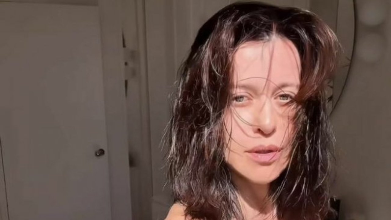 Śliczna Malwina Wędzikowska miała wypadek. Pokazała, jak wygląda jej twarz po potężnym uderzeniu [zdjęcia]