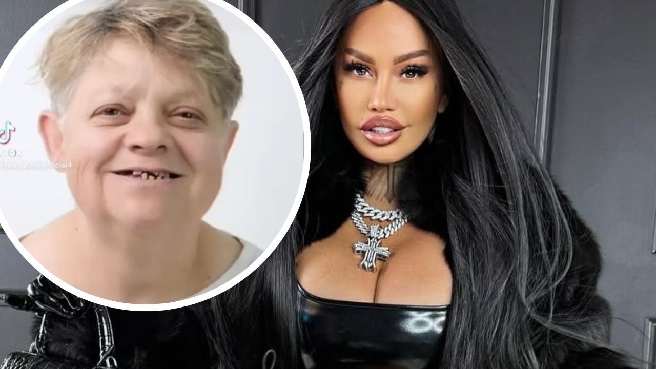 Mama Laluny ma nowe zęby z Turcji. Ludzie patrzą i nie wierzą. "Wygląda 10 lat młodziej"