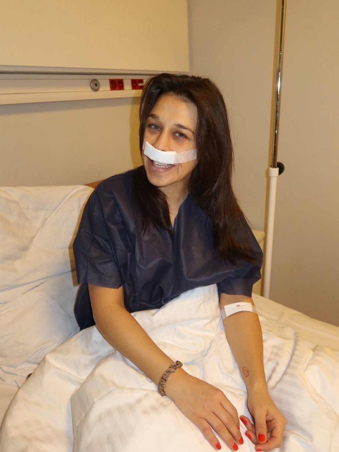 joanna jędrzejczyk z opatrunkiem na nosie