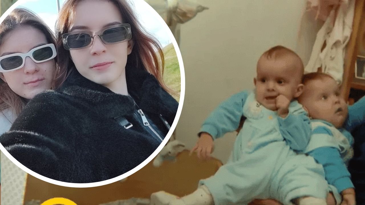 Polskie bliźniaczki syjamskie zmieniły się nie do poznania. Tak dziś wyglądają. Niewiarygodne, czym zajmują się na co dzień [dużo zdjęć]