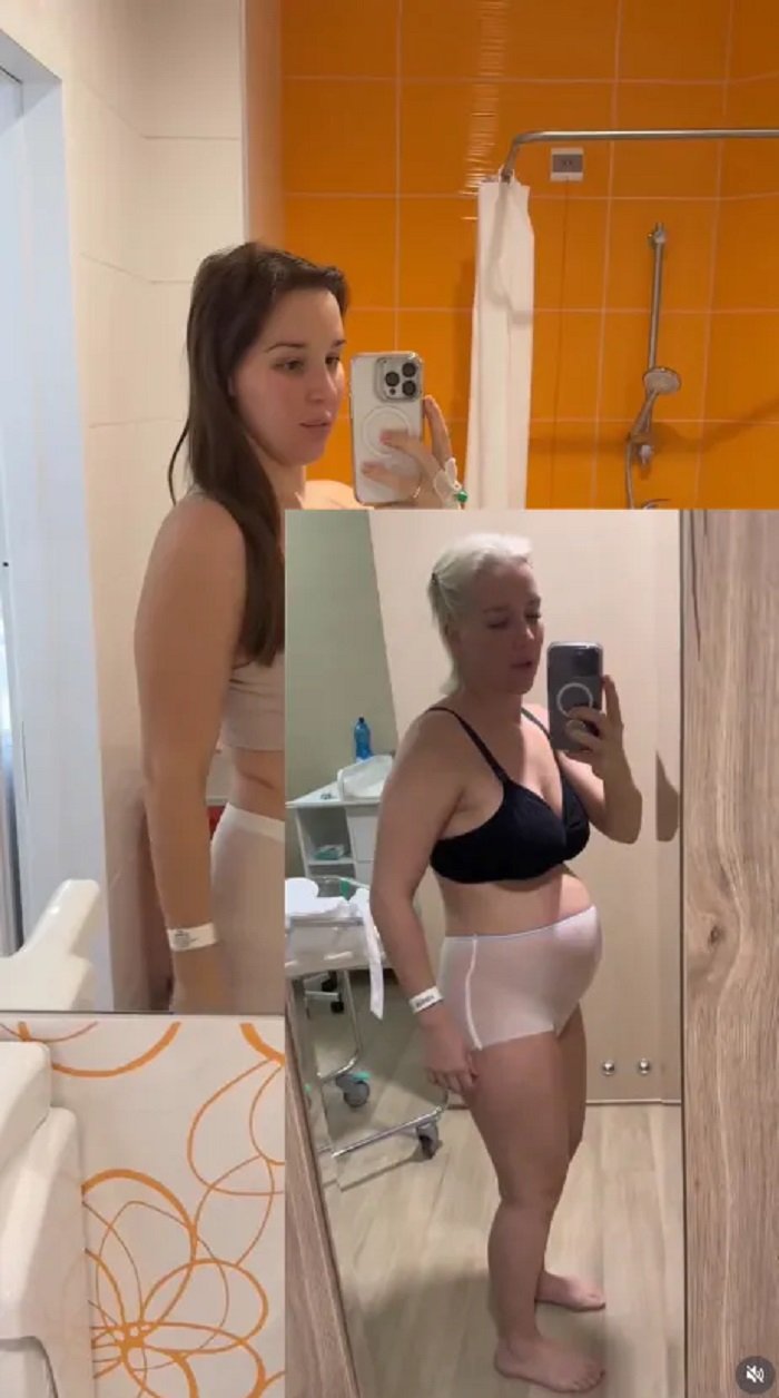 lil masti eksponuje brzuch po porodzie