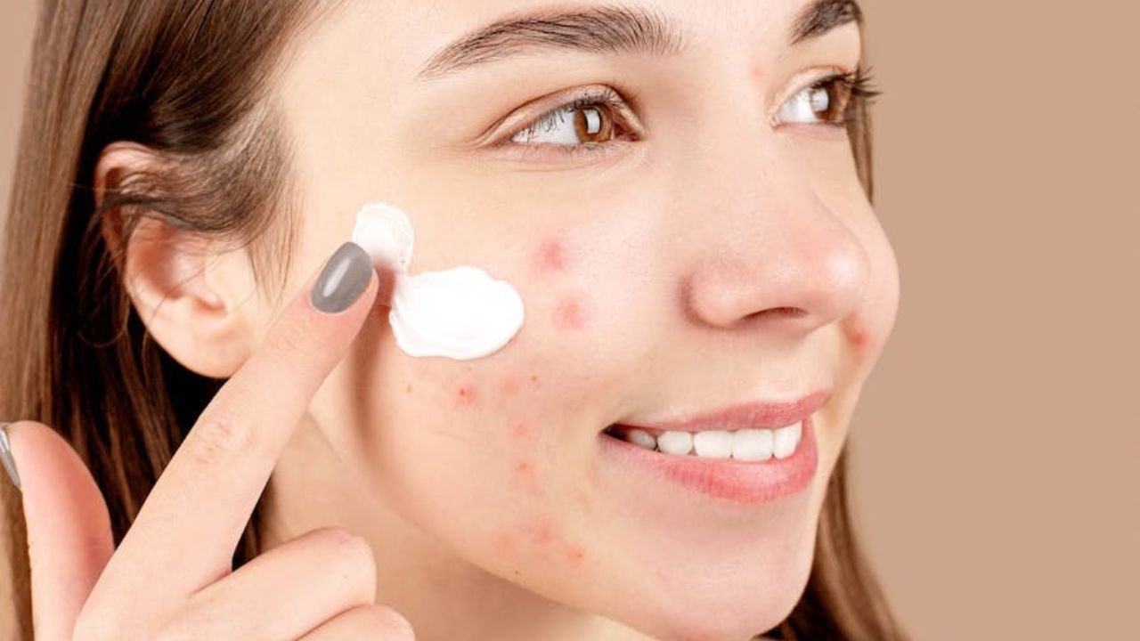 Najlepsze kosmetyki na trądzik i przebarwienia – ranking