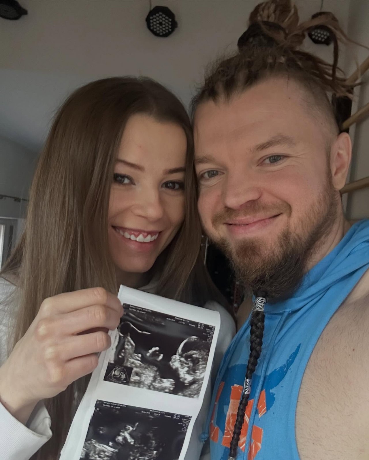 Sylwester Wardęga z ukochana trzymają zdjęcia USG