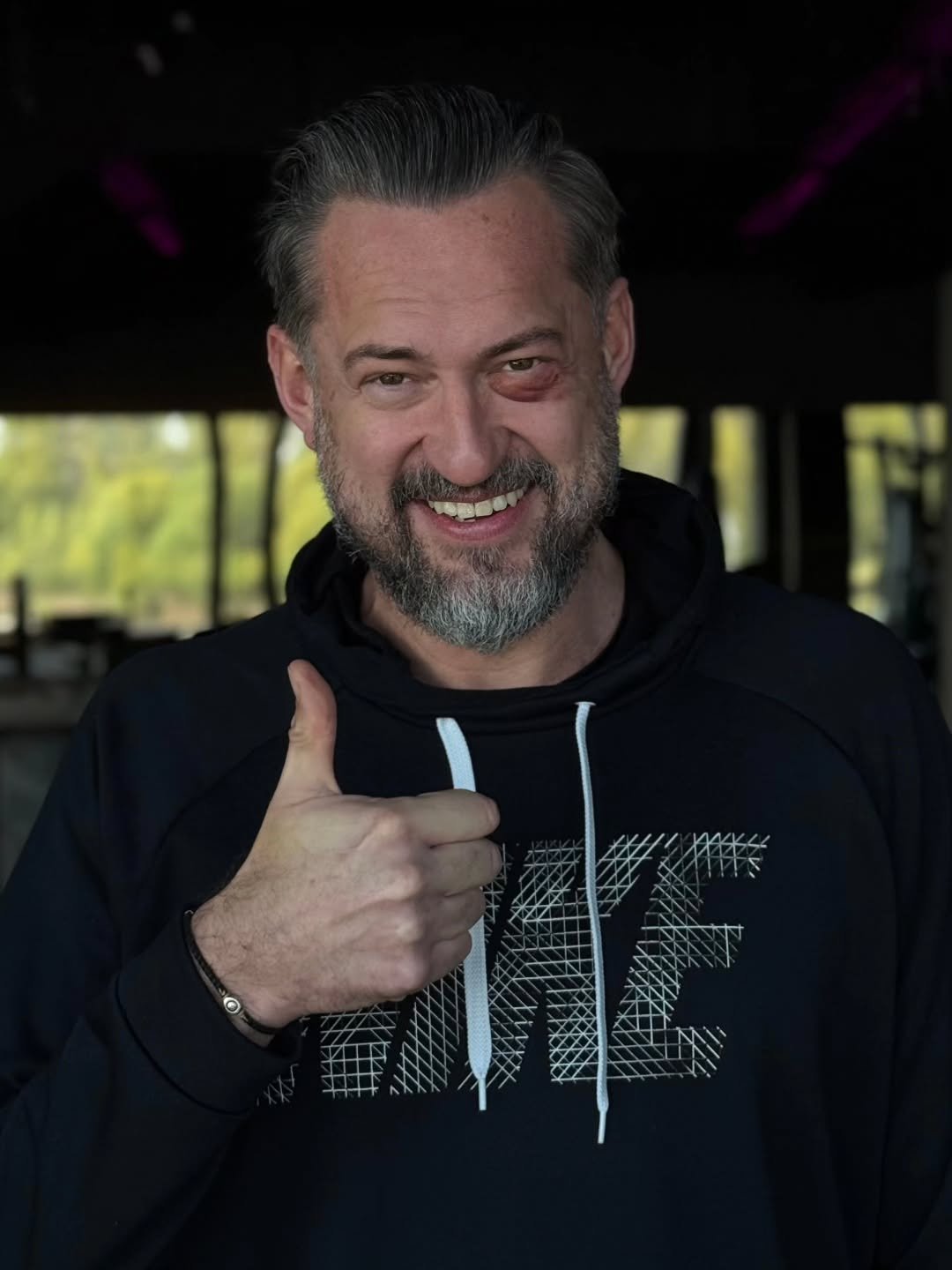 Marcin Prokop z podbitym okiem