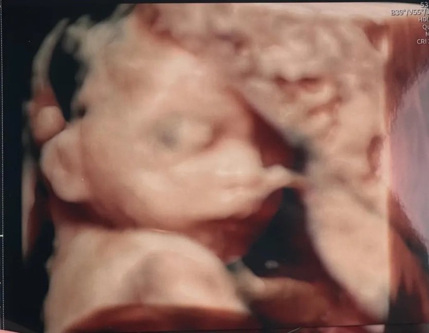 usg dziecka marty kubackiej