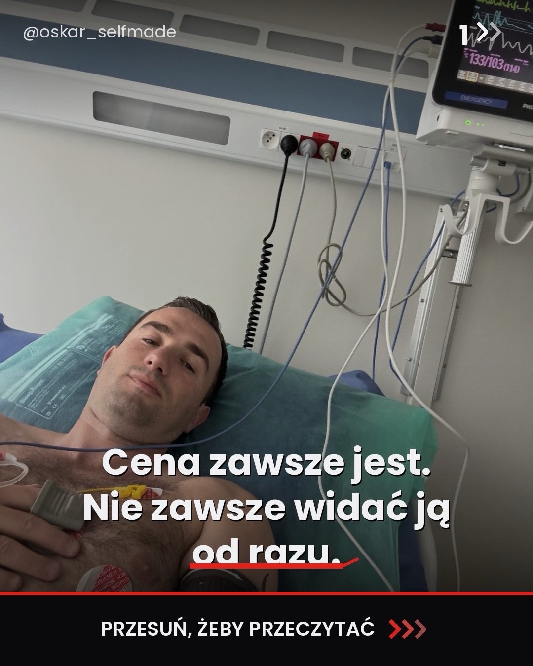Oskar WOjciechowski na szpitalnym łóżku, podpięty pod aparaturę