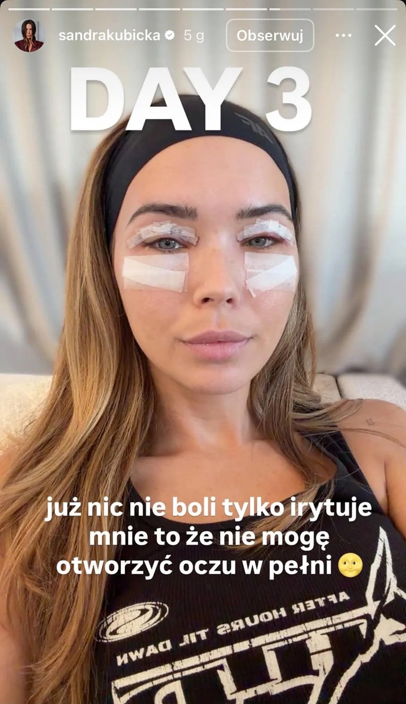 sandra kubicka z opatrunkiem na twarzu