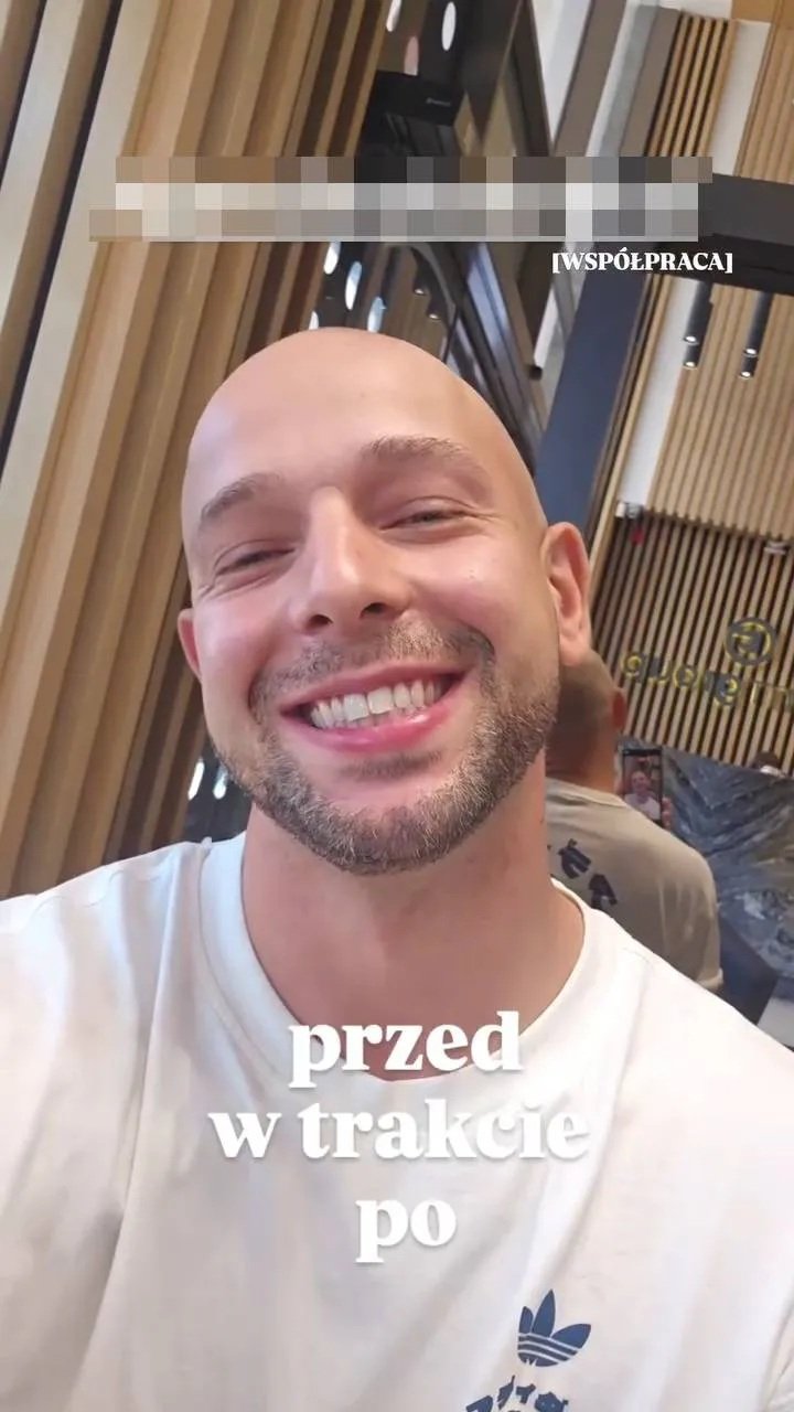 maciej pela pokazuje wybielone zeby