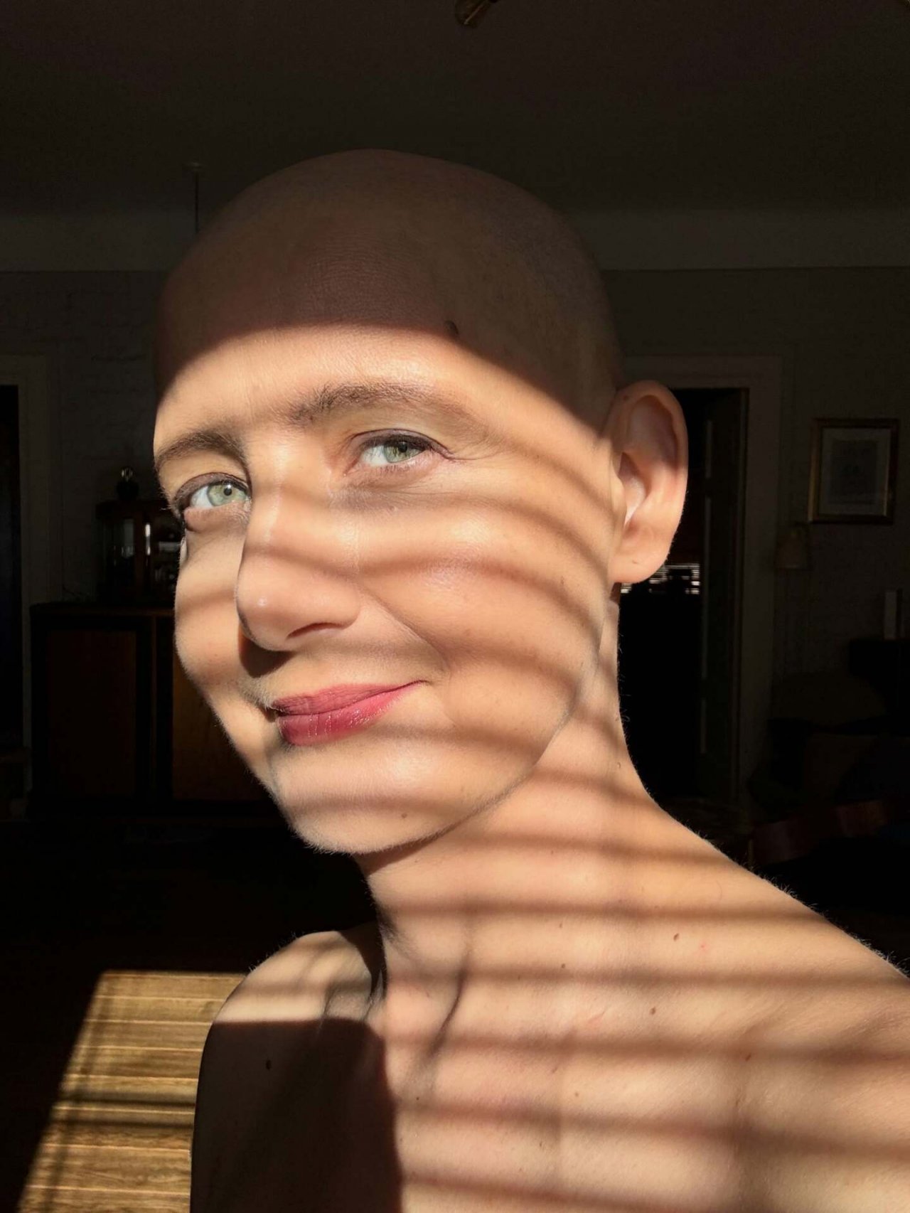 Monika Pikuła w czasie leczenia onkologicznego