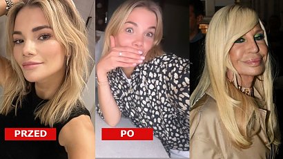 Maja Bohosiewicz powiększyła usta w Polsce! "Wyglądam jak Donatella Versace". Faktycznie?