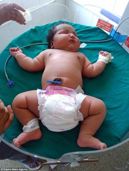 Ta dziewczynka z Indii ważyła prawie 7 kg. Jej waga nie była związana z wysokim poziomem cukru u matki ani zaburzeniami hormonalnymi. Dziecko przyszło na świat całkowicie zdrowe.