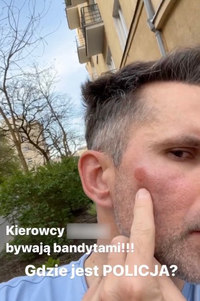 Prawdopodobnie niebawem dowiemy się, jaki był finał tego przykrego zajścia...