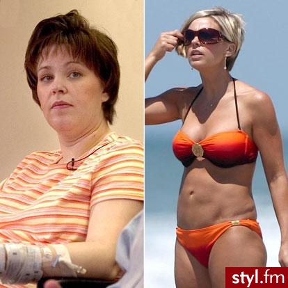 before - after :) - Misz-masz