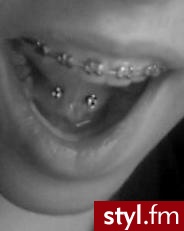 tongue web. kolczyk pod językiem,\"zamontowany\" tytanowy banan z kuleczkami wysadzanymi imitacjami cyrkonii - Modyfikacje ciała