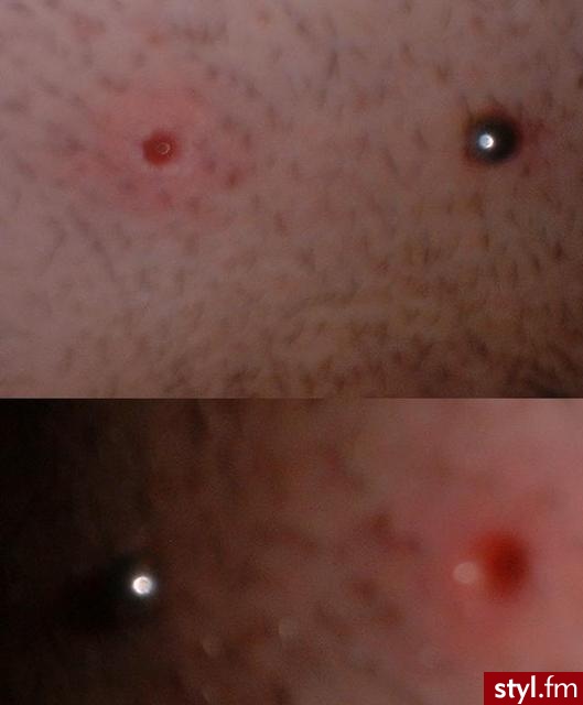 Modyfikacje ciała