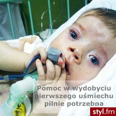 www.siepomaga.pl/bartus 
Czasem tak niewiele może zdziałać wiele...... - Nasze maluchy Dziecko