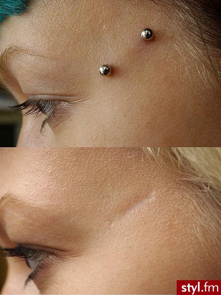 surface piercing - Modyfikacje ciała
