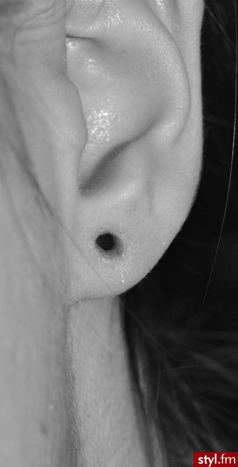 Moje 5mm. Moje 5mm - Modyfikacje ciała