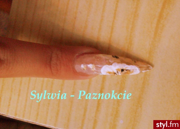 Paznokcie