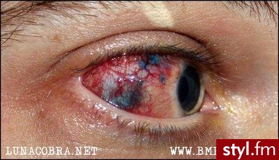 Jest to tatuaż pierwszy raz wykonany na oku efekt jak widać wygląda nie zbyt ładnie . Nie znalazłam lepszego zdjęcia .  W internecie możecie znaleźć zdjęcia i nawet filmik w którym specjaliści  wykonują ów tatuaż  . - Tatuaże
