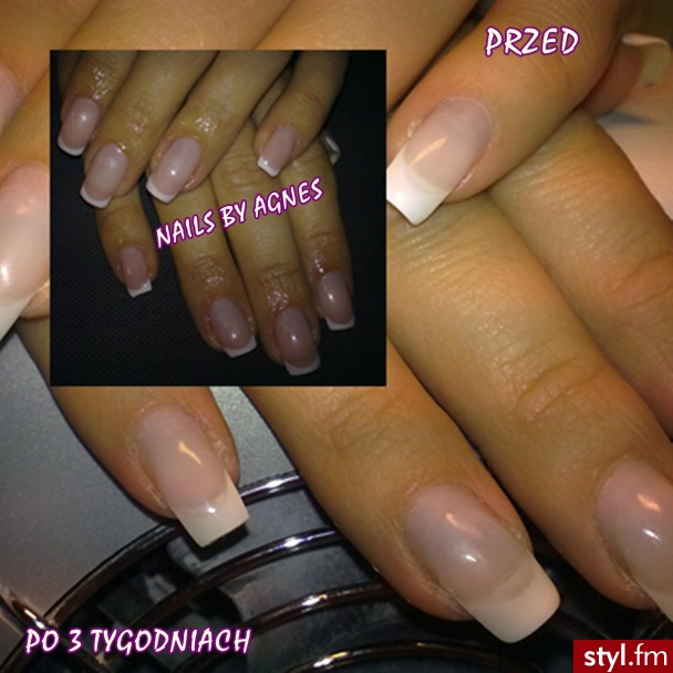 Paznokcie