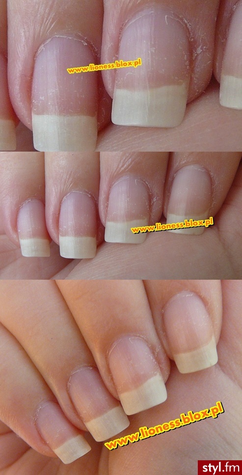 Wyniki kuracji serum La Manicure 7in1 - Loreal FILMIK: https://www.youtube.com/watch?v=4jJlJFEQ_aA NOTKA NA BLOGU: http://lioness.blox.pl/2014/03/RECENZJA-Serum-do-paznokci-La-Manicure-7w1-z.html - Kwadratowe Naturalne Paznokcie
