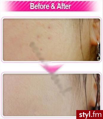 Lioele Beyond The Solution Blemish Balm BB Cream - Makijaże