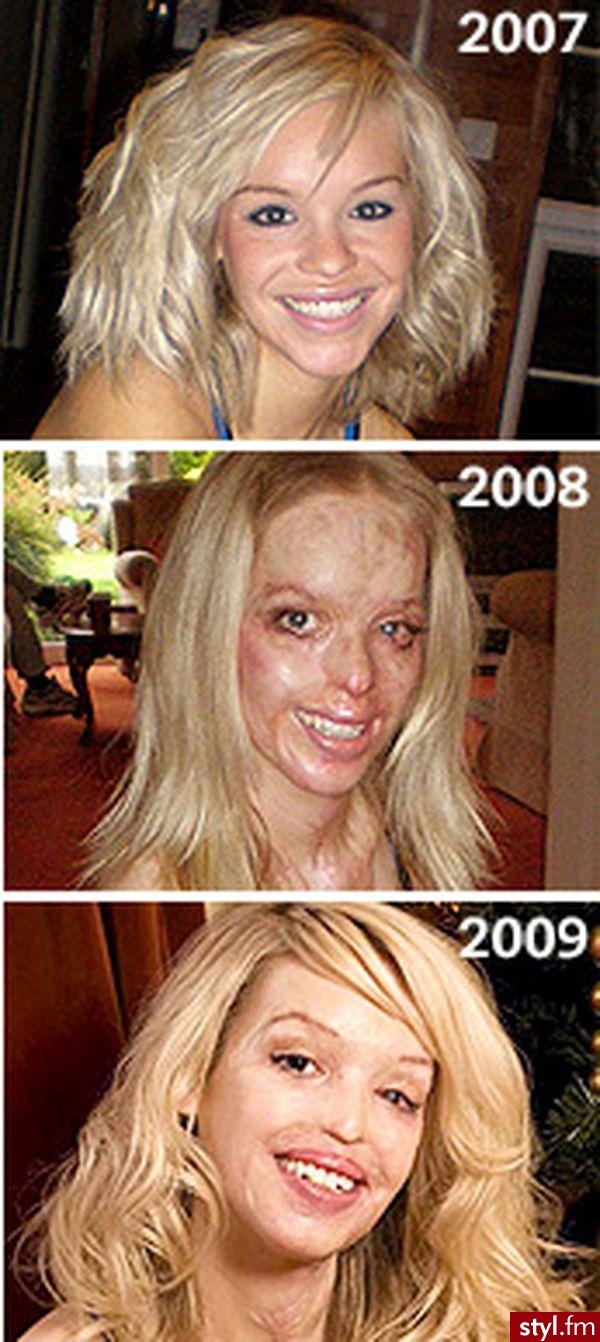 katie Piper - Średnie Fryzury