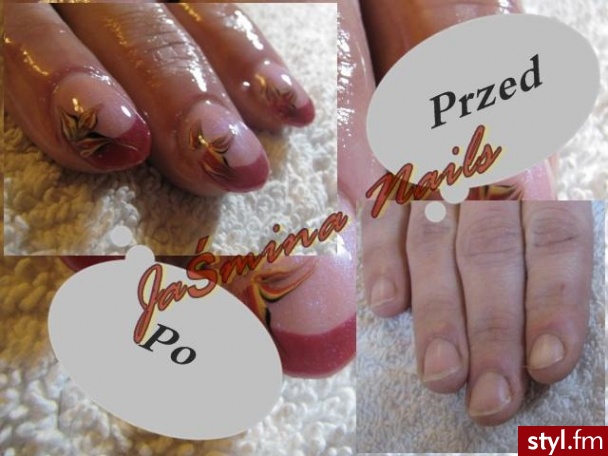 przed i po - Migdałki French Żel Paznokcie