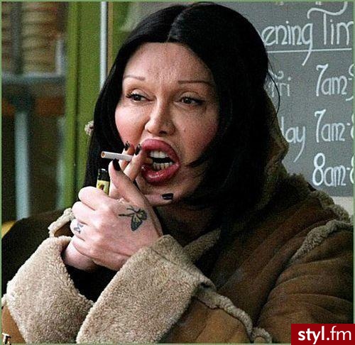 pete burns, piosenkarz. PETE BURNS, po operacjach.
piosenkarz DEAD OR ALIVE - Misz-masz