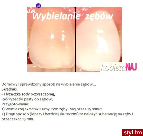 WYBIELANIE ZĘBÓW - Porady - zrób to sam