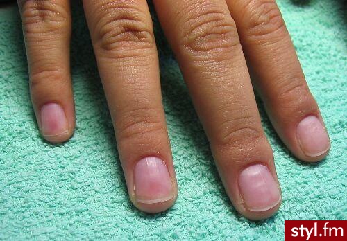 Autor: iga4 przed<justi>. Autor: <b>iga4</b><br /> przed przedlużeniem - Paznokcie