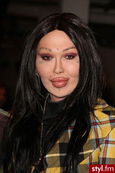 pete burns, piosenkarz. PETE BURNS, po operacjach.
piosenkarz DEAD OR ALIVE - Misz-masz