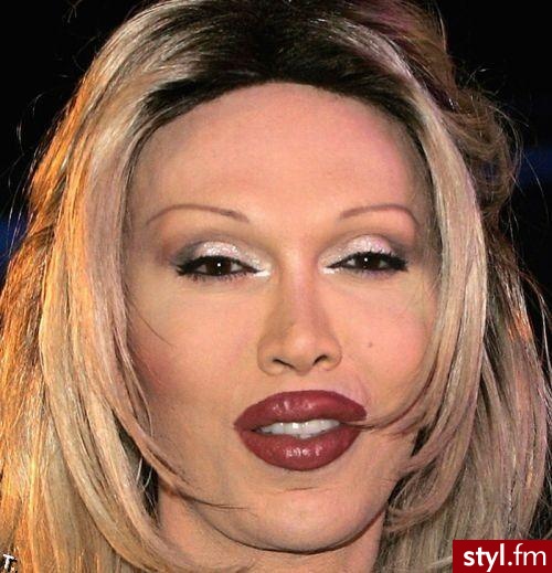 pete burns, piosenkarz. PETE BURNS, po operacjach.
piosenkarz DEAD OR ALIVE - Misz-masz