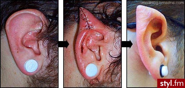 Ear pointing - Modyfikacje ciała