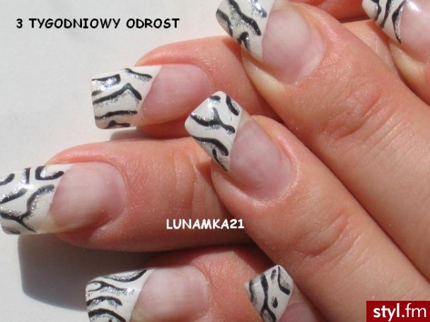 Paznokcie
