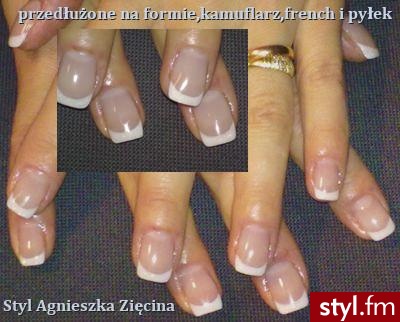 Paznokcie