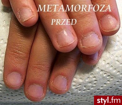 METAMORFOZA - Paznokcie