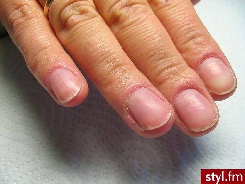 Autor: iga4 przed <bozenna>. Autor: <b>iga4</b><br /> pazurki przed przedluzeniem - Paznokcie