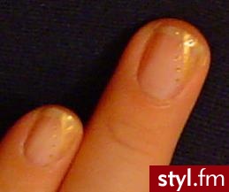 Autor: Rygi Złoto. Autor: <b>Rygi</b><br /> - Paznokcie