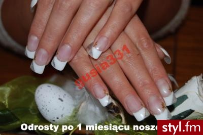 Paznokcie